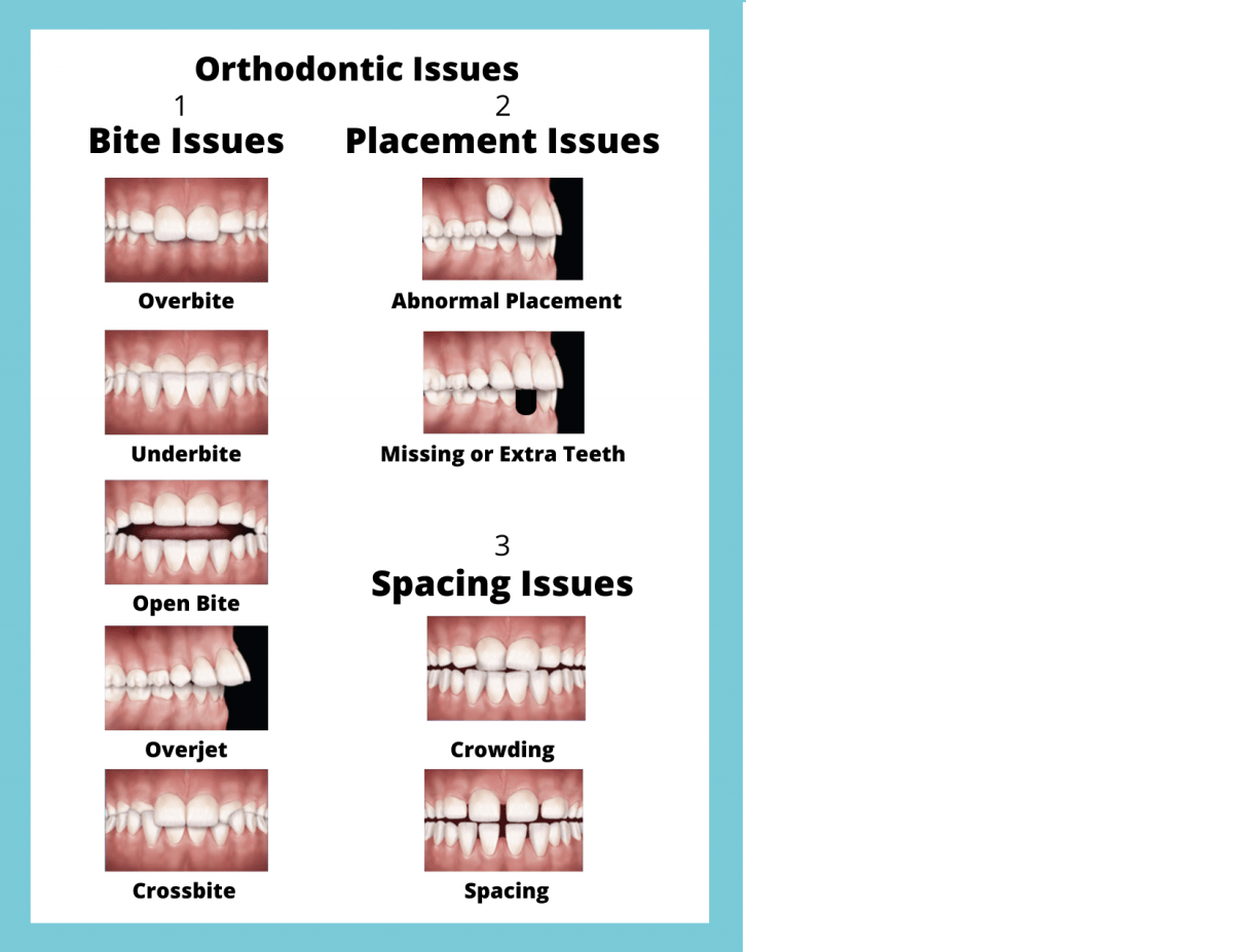 Are you in need of orthodontic treatment & what do you look for in